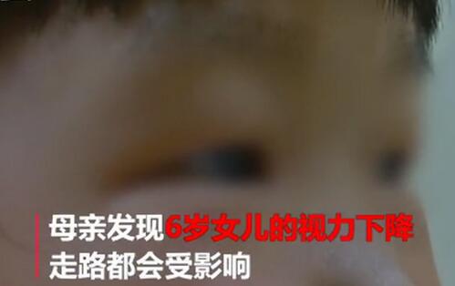 生活热点 正文     近日一位母亲发现自己6岁的女儿眼睛突然看不见了