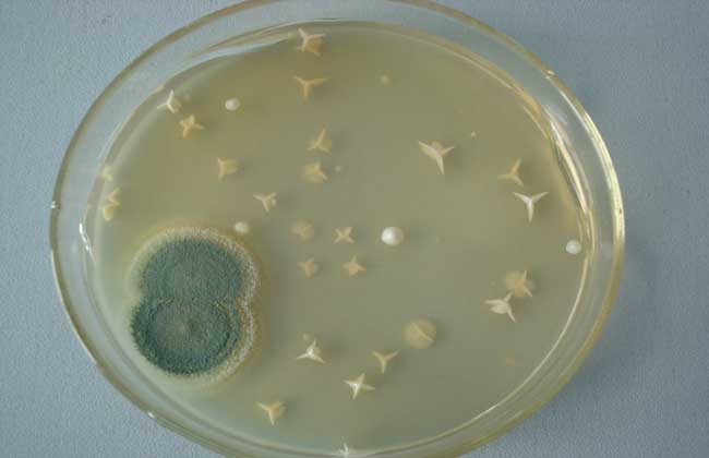 尿检酵母样菌图片